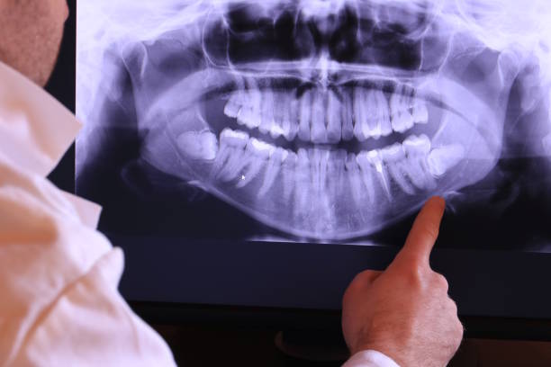 Best Pediatric Emergency Dentist in Hahnville, LA