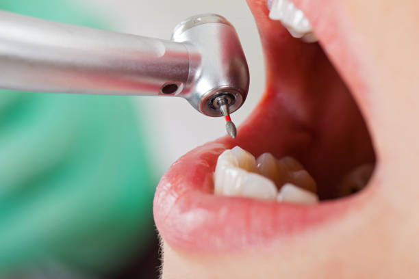Best Weekend Emergency Dentist in Hahnville, LA